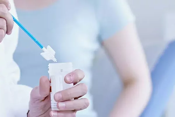 Dörtlü Tarama Testi